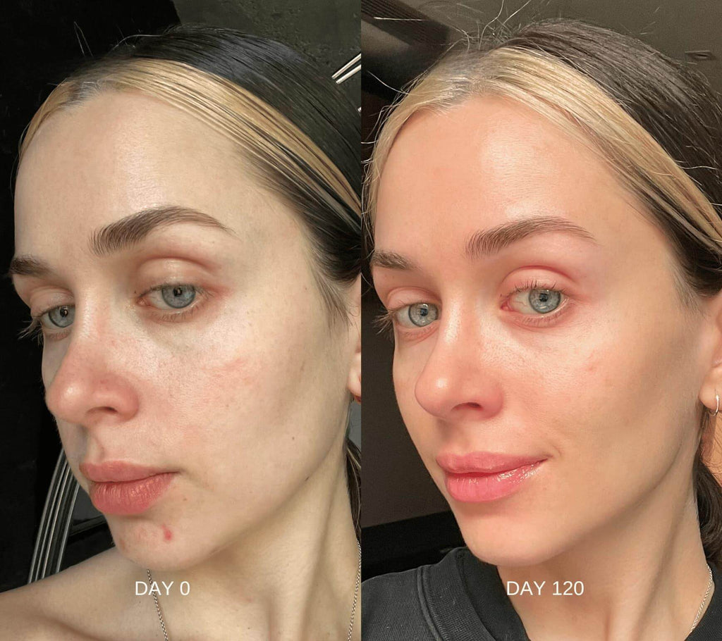 Retinal Skin Restoring Serum