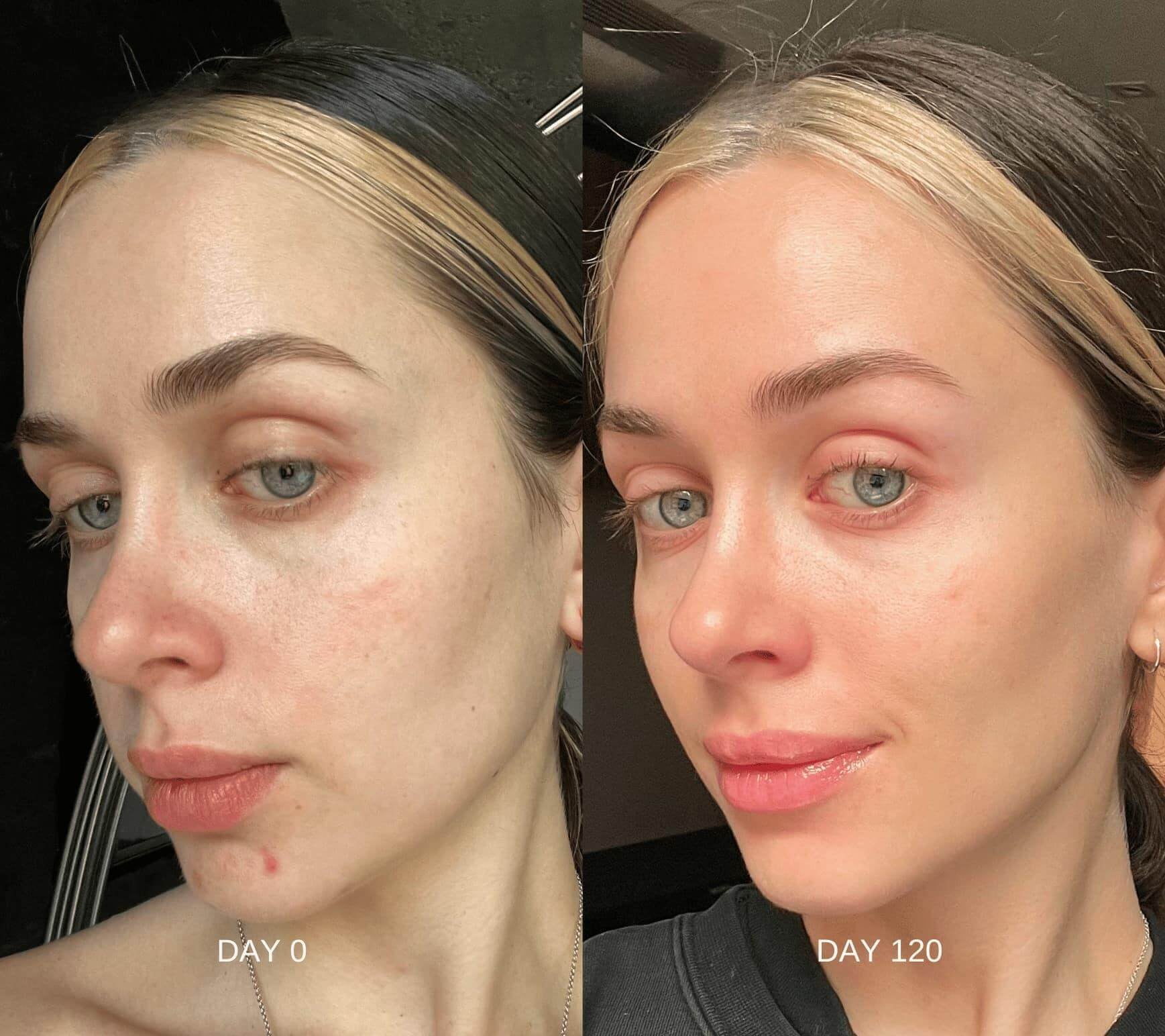 Retinal Skin Restoring Serum